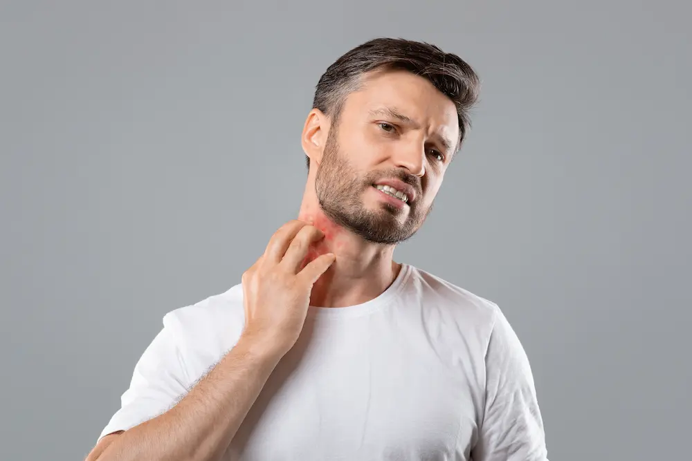 Middle-aged bearded man scratching highlighted with a red neck on grey studio background